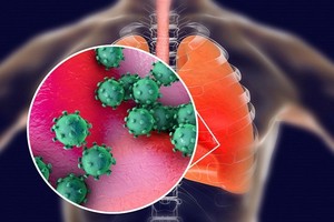 nCoV có thể sao chép ở đường hô hấp trên hoặc dưới. Ảnh: The Scientist.