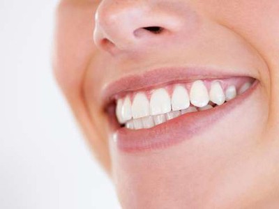 8 điểm cần lưu ý trước khi làm trắng răng