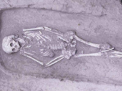 Bộ hài cốt của người thanh niên mắc hội chứng "lùn cân đối". Ảnh: Live Science. 