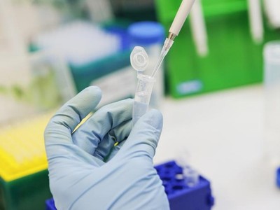 Ảnh minh họa: Quỹ đầu tư trực tiếp Nga.