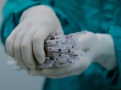 Ảnh minh họa: VABIOTECH.