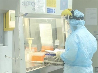 Xét nghiệm COVID-19. (Ảnh: Minh Quyết/TTXVN).