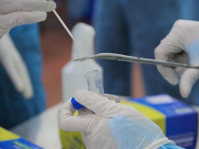 Lấy mẫu xét nghiệm tìm virus SARS-CoV-2 (Ảnh CTV).