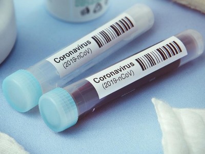 Lọ đựng mẫu xét nghiệm Covid-19. Ảnh: News expat.