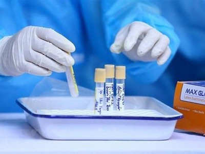 Lấy mẫu xét nghiệm COVID-19. (Ảnh: TTXVN).