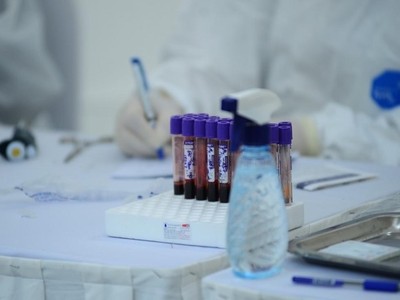 Hiện bệnh nhân đang được điều trị và cách ly tại Bệnh viện Nhiệt đới Trung ương (cơ sở 2 Đông Anh).