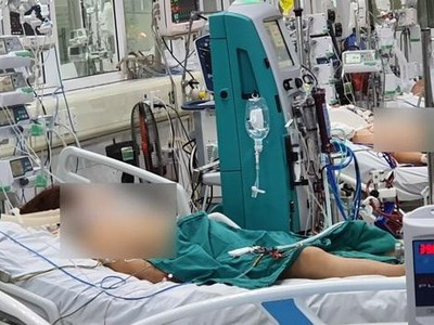 Bệnh nhân Covid-19 nặng được điều trị tại Bệnh viện Bệnh Nhiệt đới Trung ương.