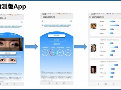 Trung Quốc phát triển công nghệ phát hiện nguy cơ mắc Covid-19 qua kiểm tra mắt (Ảnh: The Paper).