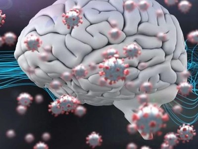 Ảnh minh họa. (Nguồn: newatlas.com)