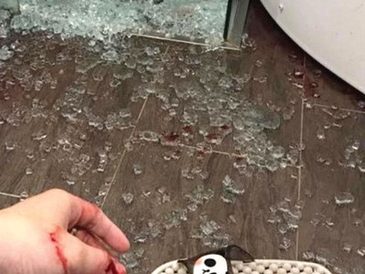 Chủ nhân căn hộ bị thương do kính cường lực trong nhà tắm nổ. Ảnh: Nguyễn Thành

