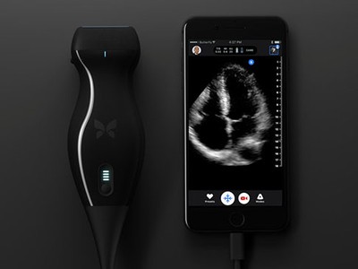 Biến smartphone thành máy siêu âm cầm tay bằng thiết bị Butterfly iQ