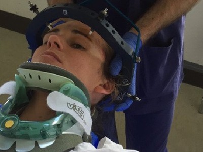 5 năm trước hắt hơi gãy cổ, 5 năm sau lại gãy cổ vì cười