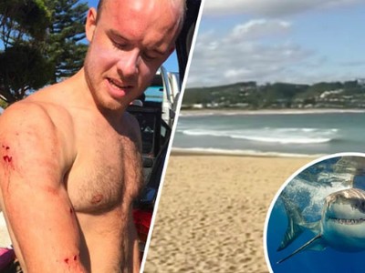 Fry bị thương nhẹ và được các bạn đưa đến bệnh viện kiểm tra sức khỏe. Ảnh: Daily Star.