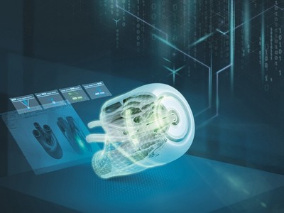 Công nghệ in 3D của Tập đoàn Siemens.