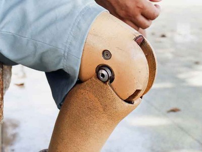 Một người gốc Á ăn xin tại UAE giấu gần 240 triệu đồng trong chiếc chân giả. (Nguồn: Courtesy).