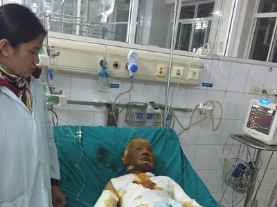 Chị Hợi đang chăm sóc cháu Tuấn trong bệnh viện.