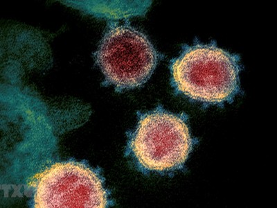 Virus SARS-CoV-2 gây bệnh COVID-19 soi trên kính hiển vi. (Ảnh: AFP/ TTXVN).