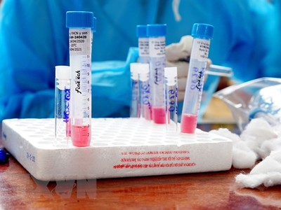 Các mẫu sinh phẩm xét nghiệm của người dân trong khu vực phong tỏa. (Ảnh: TTXVN phát).