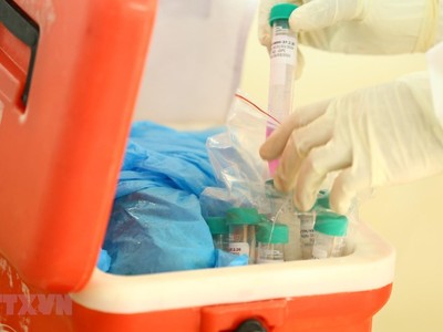 Các mẫu bệnh phẩm chuyển đến các đơn vị xét nghiệm bằng phương pháp RT-PCR. (Ảnh: Minh Quyết/TTXVN).