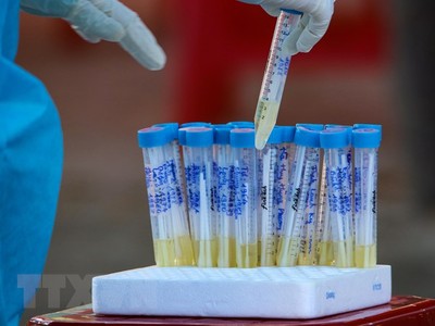 Các ống nghiệm đựng mẫu được ghi tên, tuổi theo từng nhóm của đối tượng được lấy mẫu xét nghiệm ở Đà Nẵng. (Ảnh: Trần Lê Lâm/TTXVN).