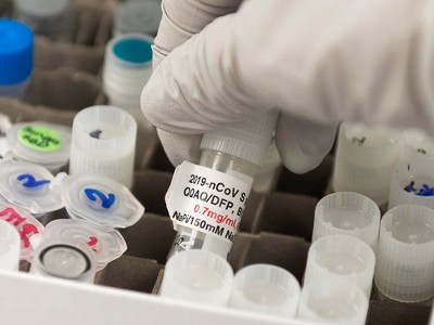 Vắcxin ngừa COVID-19 được phát triển bởi công ty Novavax tại Gaithersburg, bang Maryland, Mỹ ngày 20/3/2020. (Ảnh: AFP/TTXVN).