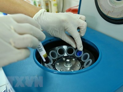 Báo động tình trạng người Việt Nam thừa cholesterol ở mức cao