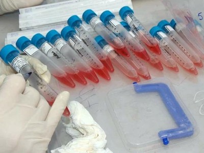 Bệnh viện Phổi Trung ương đã có văn bản gửi Sở Y tế Hưng Yên về trường hợp trên.