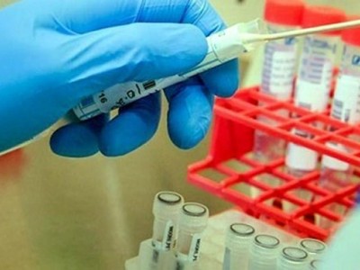 JCVI khuyến cáo Chính phủ Anh nên triển khai tiêm vaccine COVID-19 theo độ tuổi hơn là theo tính chất nghề nghiệp (Ảnh minh họa: KT).