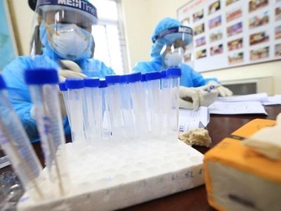 Lấy mẫu xét nghiệm ca bệnh COVID-19. (Ảnh: Thành Đạt/TTXVN).