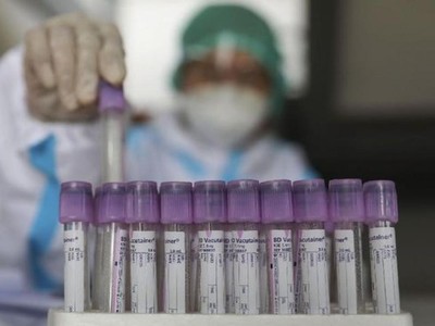 Indonesia phát hiện biến chủng SARS-CoV-2 từ Ấn Độ và Nam Phi. (Ảnh minh họa: CNN Indonesia).