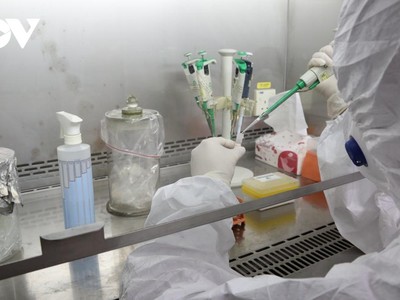 Cán bộ CDC Yên Bái làm xét nghiệm.