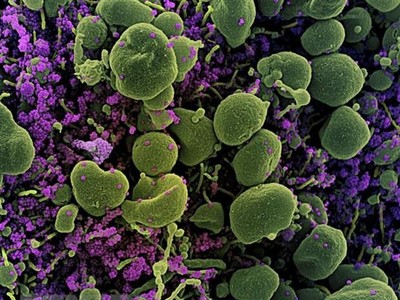 Ảnh minh họa. (Nguồn: AFP/TTXVN).