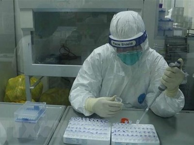 Xét nghiệm COVID-19. (Ảnh: Thanh Thương/TTXVN).