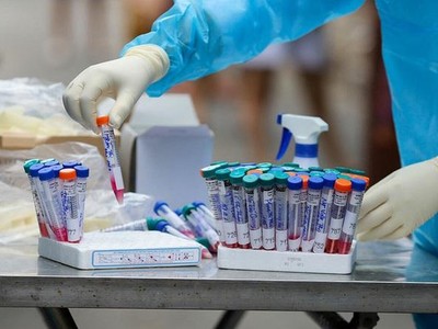 Ngày 9/5, bệnh nhân tiếp tục được làm xét nghiệm SARS-CoV-2 và cho kết quả dương tính.