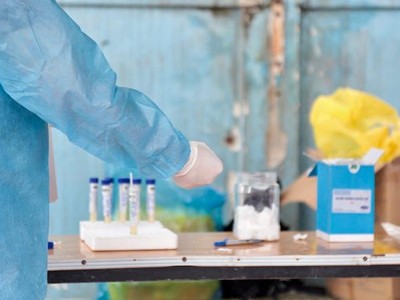 Lực lượng y tế tỉnh bà Rịa - Vũng Tàu sẽ lấy mẫu xét nghiệm các trường hợp F1, F2 liên quan đến ca dương tính Covid-19 là nhân viên thu gom rác ở Bình Dương.