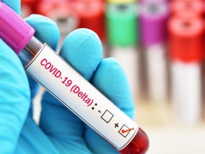 Cộng hòa Séc và Slovakia thắt chặt các quy định nhập cảnh đối với công dân chưa được tiêm chủng đầy đủ đến từ các quốc gia có nguy cơ lây nhiễm cao (Ảnh minh họa, nguồn expats.cz).