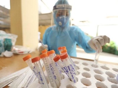 Nhân viên y tế làm công tác xét nghiệm. (Ảnh: TTXVN/Vietnam+).