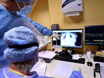 Nhân viên y tế theo dõi hình chụp X-quang phổi của bệnh nhân COVID-19 tại Rome, Italy. (Ảnh: AFP/TTXVN)