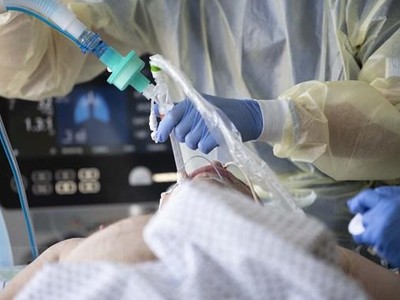 Nhân viên y tế điều trị cho bệnh nhân COVID-19. (Ảnh: AFP/TTXVN)