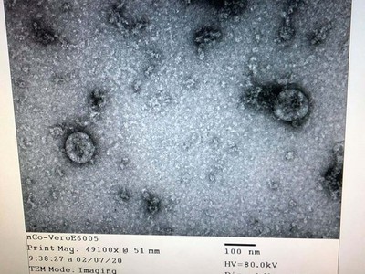 Viện vệ sinh dịch tễ Trung ương đã nuôi cấy và phân lập thành công virus corona mới. (Nguồn: Bộ Y tế)
