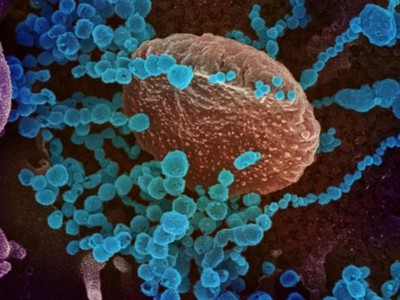 Delta là biến thể Covid-19 nhanh nhất, khỏe nhất và sẽ ảnh hưởng những người dễ bị tổn thương nhất