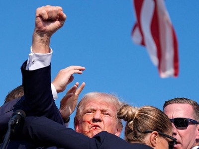 Ông Trump bị thương ở vùng tai phải. (Nguồn: AP)