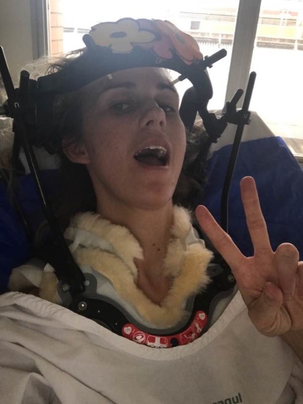 5 năm trước hắt hơi gãy cổ, 5 năm sau lại gãy cổ vì cười ảnh 2