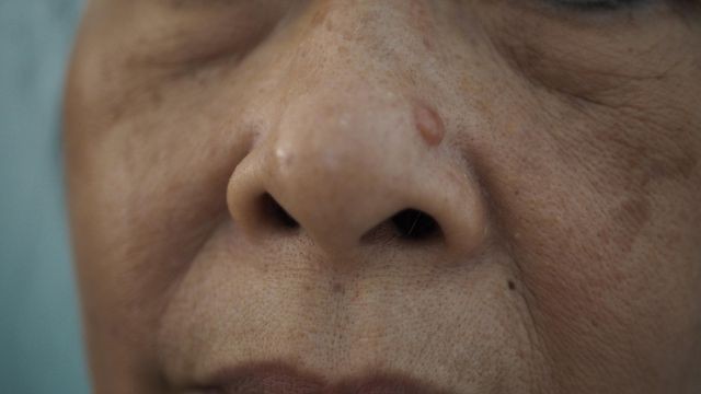 Làn da nguy cơ bị ung thư từ những yếu tố ít ai ngờ tới ảnh 1