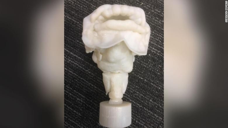 Tái tạo lại giọng nói của xác ướp Ai Cập 3.000 năm tuổi ảnh 1