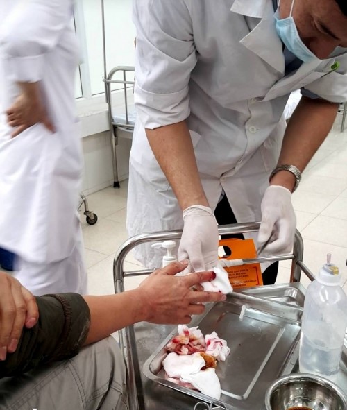 Nhà báo Đỗ Doãn Hoàng - báo Lao Động bị 3 đối tượng lạ mặt hành hung dã man ảnh 1