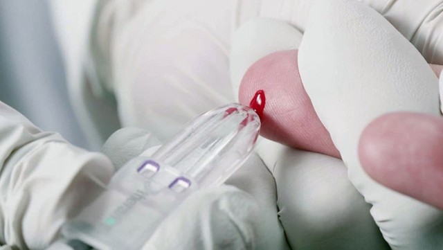 Trò lừa đảo lớn nhất Thung lũng Silicon ảnh 1