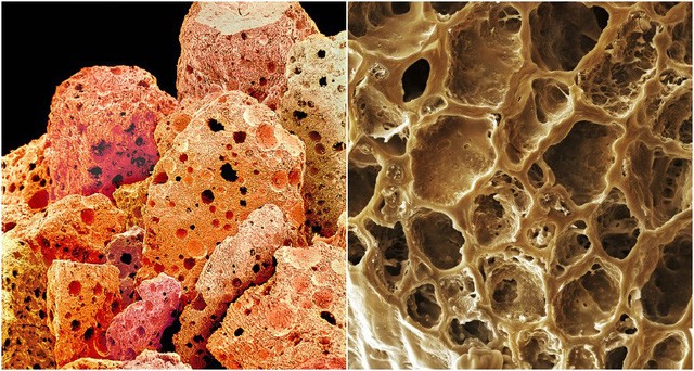 Sự khác nhau giữa bột cà phê uống liền (trái) và hạt cà phê rang (phải) khi được phóng đại lên hàng ngàn lần.