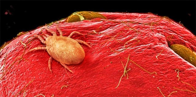  Thực tế, trên bề mặt của quả dâu tây luôn tồn tại loài nhện ký sinh có kích thước hiển vi. Tuy nhiên, cũng đừng tỏ ra quá lo ngại bởi chúng hoàn toàn vô hại với con người. 