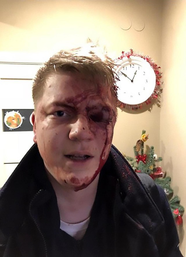 Triệu phú Bitcoin bị trộm hơn 8,6 tỷ đồng vì khoe tiền trên mạng xã hội ảnh 1